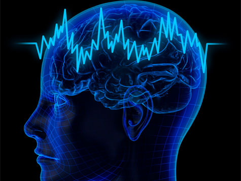 cerebro150513